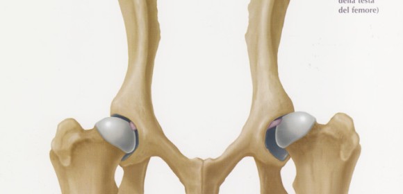 Displasia dell’anca, prevenzione e tecniche chirurgiche